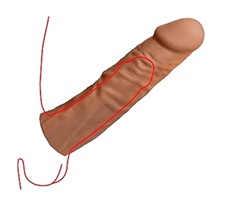 penis extender